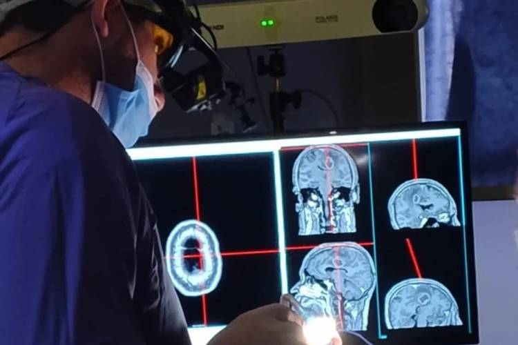 Se realizaron por primera vez en Córdoba tres neurocirugías inéditas